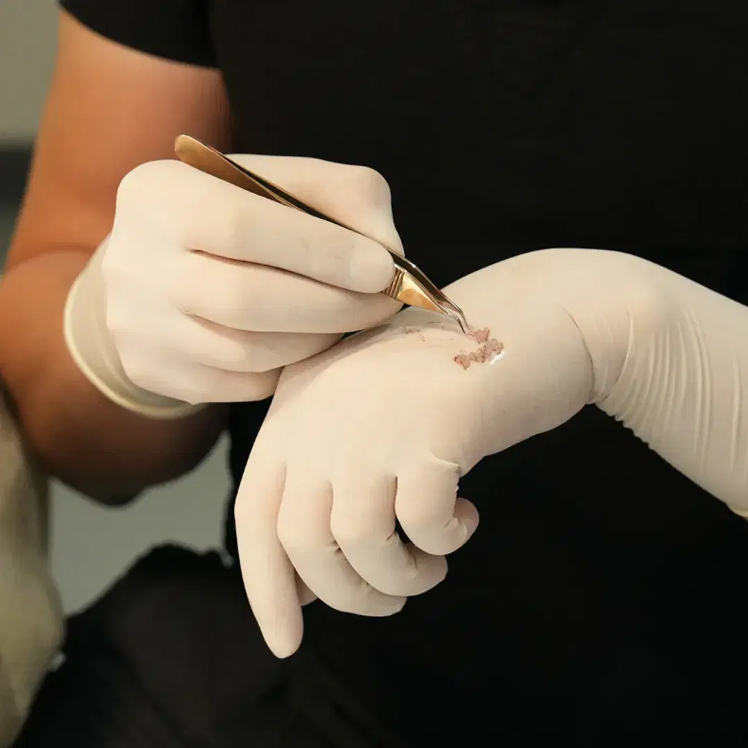 <h3><span style="color: rgb(247, 248, 248);">Careful Donor Extraction</span></h3>