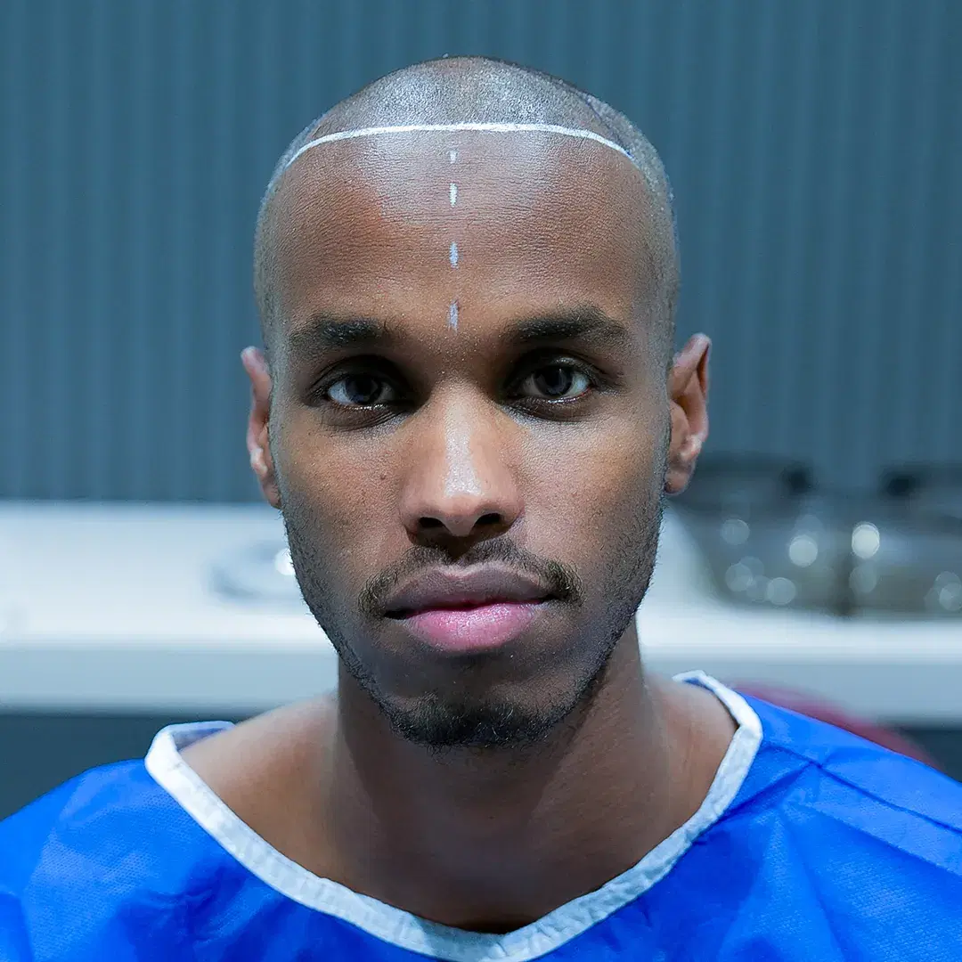 <h3><span style="color: rgb(247, 248, 248);">Consultation and Hair Analysis</span></h3>