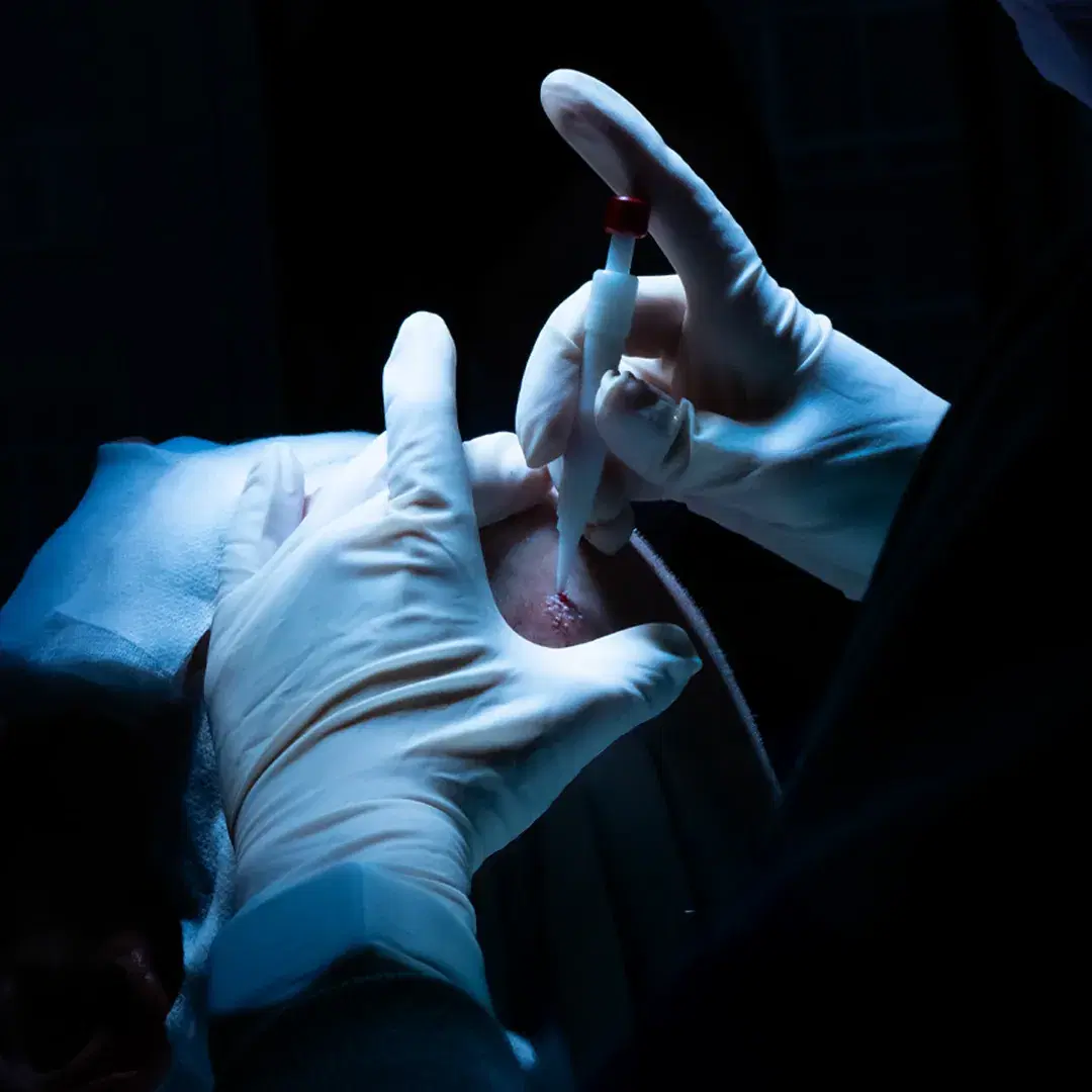 <h3><span style="color: rgb(247, 248, 248);">Implantation Phase</span></h3>